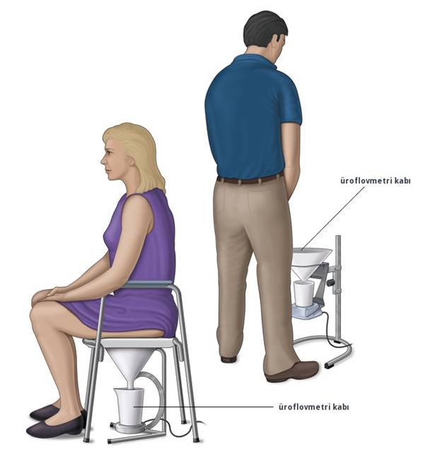 C:\Users\PC\Desktop\uroflowmeter.jpg
